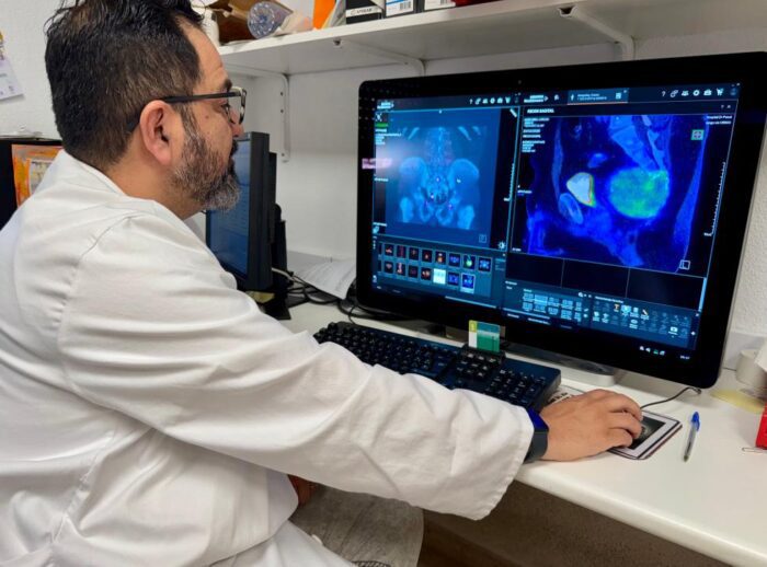 El Hospital Doctor Peset incorpora la cirugía radioguiada y molecular para mejorar la localización de tumores complejos de columna